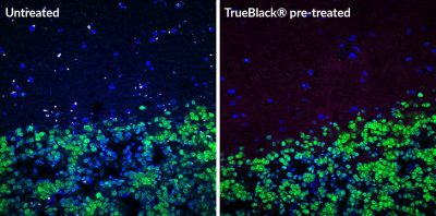 TrueBlack Lipofuscin Autofluorescence Quencher pre-treatment