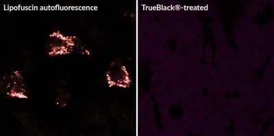 TrueBlack Lipofuscin Autofluorescence Quencher