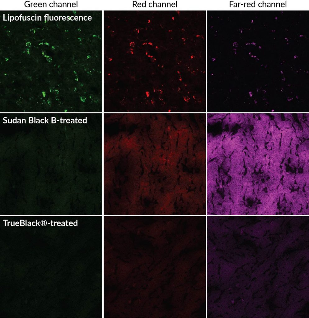 TrueBlack Lipofuscin Autofluorescence Quencher vs Sudan Black B