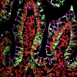 Tyramide Signal Amplification - Biotium