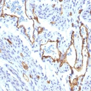 CD31 / PECAM-1 Recombinant Monoclonal Rabbit Antibody (C31/1395R)