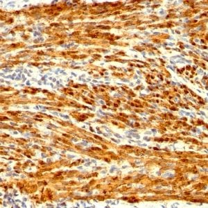 Calponin-1 Recombinant Monoclonal Rabbit Antibody (CNN1/1408R)