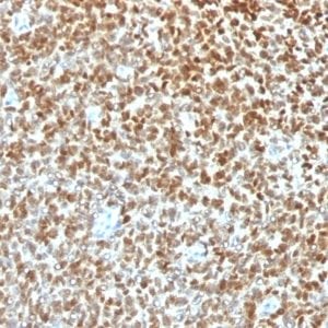 NKX2.2 Recombinant Monoclonal Rabbit Antibody (NX2/1422R)