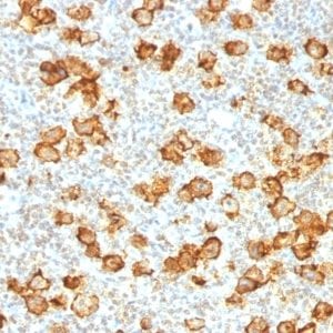 CD30 / TNFRSF8 Recombinant Monoclonal Rabbit Antibody (Ki-1/1505R)