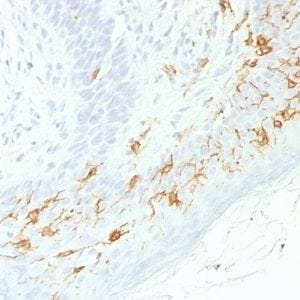 CD1a Recombinant Monoclonal Rabbit Antibody (C1A/1506R)