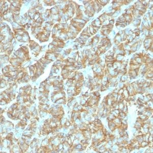 Ep-CAM / CD326 Recombinant Monoclonal Rabbit Antibody (EGP40/1555R)