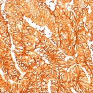 Ep-CAM / CD326 Recombinant Monoclonal Rabbit Antibody (EGP40/1556R)