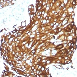 Cytokeratin, Acidic Recombinant Monoclonal Rabbit Antibody (KRTL/1577R)