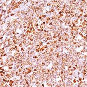 CD79a Recombinant Monoclonal Rabbit Antibody (IGA/1688R)