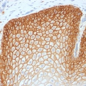 CD44v4 Recombinant Monoclonal Rabbit Antibody (CD44v4/1700R)