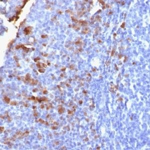 Human IgG Recombinant Monoclonal Rabbit Antibody (IG1707R)