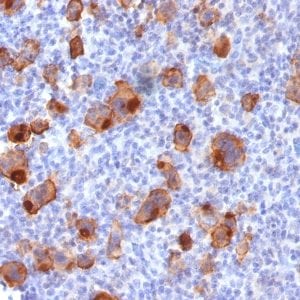 CD30 / TNFRSF8 Recombinant Monoclonal Rabbit Antibody (Ki-1/1747R)