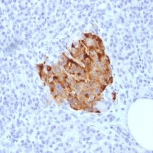 Chromogranin A Recombinant Monoclonal Rabbit Antibody (CHGA/1773R)