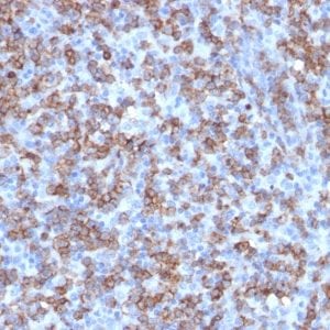 CD8A Recombinant Monoclonal Rabbit Antibody (C8/1779R)