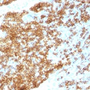 CD45RB Recombinant Monoclonal Rabbit Antibody (PTPRC/1783R)