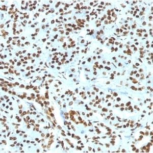 Histone H1 Recombinant Monoclonal Rabbit Antibody (HH1/1784R)