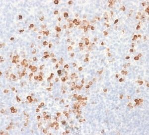 Formalin-fixed paraffin-embedded human Tonsil stained with IgG Mouse Recombinant Monoclonal Antibody (rIG266).