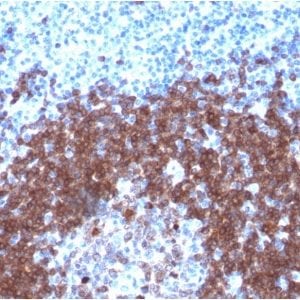 Formalin-fixed paraffin-embedded human Tonsil stained with CD79a Rabbit Recombinant Monoclonal Antibody (IGA/1790R).