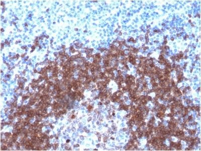 Formalin-fixed paraffin-embedded human Tonsil stained with CD79a Rabbit Recombinant Monoclonal Antibody (IGA/1790R).