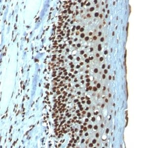 Histone H1 Recombinant Monoclonal Mouse Antibody (r1415-1)