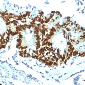 p53 Tumor Suppressor Recombinant Monoclonal Rabbit Antibody (Tp53/1799R)