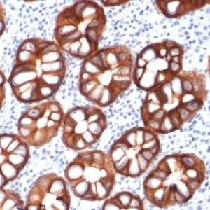 Ep-CAM / CD326 Recombinant Monoclonal Mouse Antibody (rMOC-31)