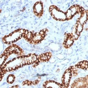 Ksp-Cadherin / CDH16 Recombinant Monoclonal Mouse Antibody (rCDH16/1071)