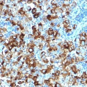 gp100 / Melanosome / PMEL17 / SILV Recombinant Monoclonal Rabbit Antibody (PMEL/1825R)
