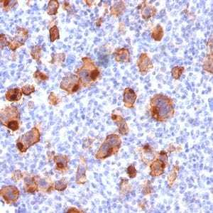 CD30 / TNFRSF8 Recombinant Monoclonal Mouse Antibody (rKi-1/779)