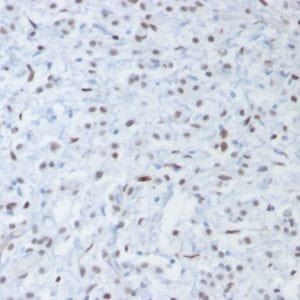 Formalin-fixed, paraffin-embedded human testis stained with Wilm’s Tumor Mouse Recombinant Monoclonal Antibody (rWT1/857).