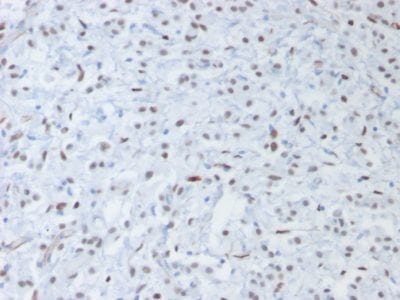 Formalin-fixed, paraffin-embedded human testis stained with Wilm’s Tumor Mouse Recombinant Monoclonal Antibody (rWT1/857).