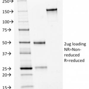 SDS-PAGE Analysis Purified HER-2 Mouse Monoclonal Antibody (HRB2/282). Confirmation of Purity and Integrity of Antibody.