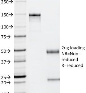 SDS-PAGE Analysis Purified p53 Mouse Monoclonal Antibody (PAb122). Confirmation of Purity and Integrity of Antibody.