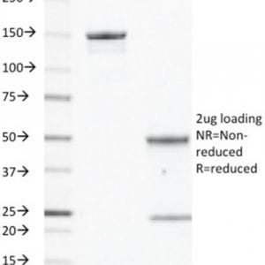 SDS-PAGE Analysis Purified EGFR Mouse Monoclonal Antibody (GFR/450). Confirmation of Purity and Integrity of Antibody.