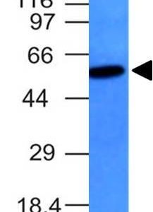 Western Blot Raji Cell Lysate Vimentin Mouse Monoclonal Antibody (VM452).