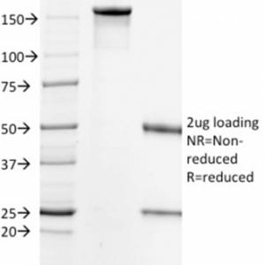 SDS-PAGE Analysis Purified HER-2 Mouse Monoclonal Antibody (HRB2/718). Confirmation of Purity and Integrity of Antibody.