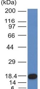 Western Blot Analysis of recombinant fragment of CD117 with CD117 Mouse Monoclonal Antibody (KIT/982).