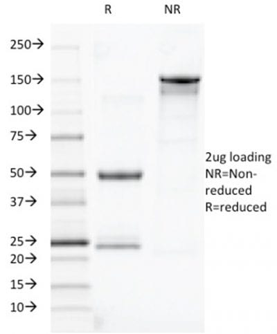 SDS-PAGE Analysis Purified TOX3 Mouse Monoclonal Antibody (TOX3/1123). Confirmation of Purity and Integrity of Antibody.