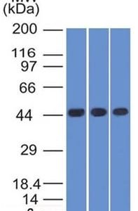 Western Blot of K562 HEK293 and A549 Cell Lysates Using Napsin A Mouse Monoclonal Antibody (NAPSA/1238).