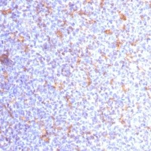 Formalin-fixed paraffin-embedded human Tonsil stained with CD11c Mouse Monoclonal Antibody (ITGAX/1284).