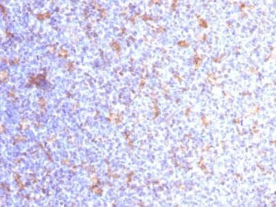 Formalin-fixed paraffin-embedded human Tonsil stained with CD11c Mouse Monoclonal Antibody (ITGAX/1284).