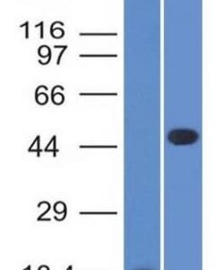 Western Blot of recombinant Adipophilin and Jurkat Cell Lysate using Adipophilin Mouse Monoclonal Antibody (ADFP/1365).