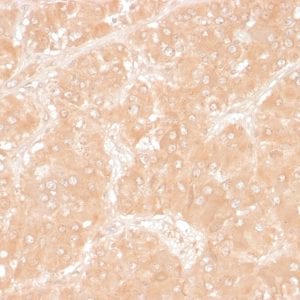 Formalin-fixed paraffin-embedded Human Adrenal stained with Adipophilin Mouse Monoclonal Antibody (ADFP/1366).