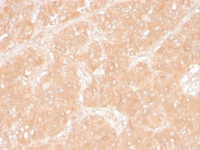 Formalin-fixed paraffin-embedded Human Adrenal stained with Adipophilin Mouse Monoclonal Antibody (ADFP/1366).