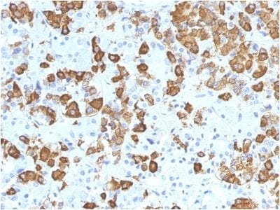 Formalin-fixed paraffin-embedded Human Pituitary stained with Growth Hormone Monoclonal Antibody (GH/1371).