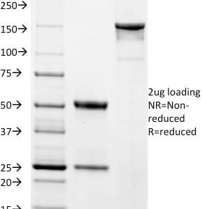 SDS-PAGE Analysis Purified EpCAM Mouse Monoclonal Antibody (EGP40/1384). Confirmation of Purity and Integrity of Antibody.
