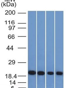 Western Blot of A431 HeLa Liver and Testis Lysate using Ferritin Light Chain Mouse Monoclonal Antibody (FTL/1386).