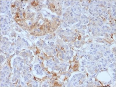 Formalin-fixed paraffin-embedded Human Pancreas stained with Ferritin Light Chain Monoclonal Antibody (FTL/1388).
