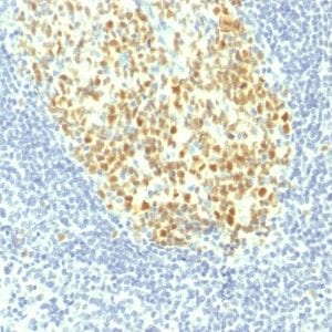 Formalin-fixed paraffin-embedded human Tonsil stained with MCM7 Mouse Monoclonal Antibody (MCM7/1467).