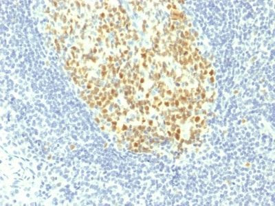 Formalin-fixed paraffin-embedded human Tonsil stained with MCM7 Mouse Monoclonal Antibody (MCM7/1467).